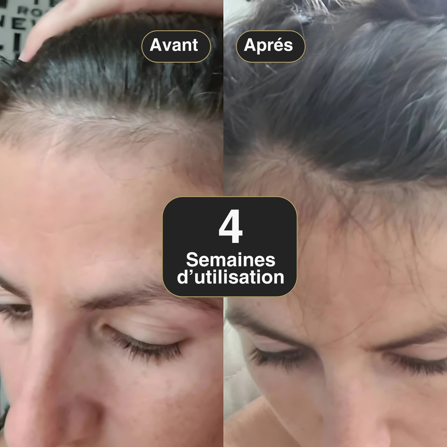 Pack Régénérant Ikleel – Offrez à vos cheveux une nouvelle vie