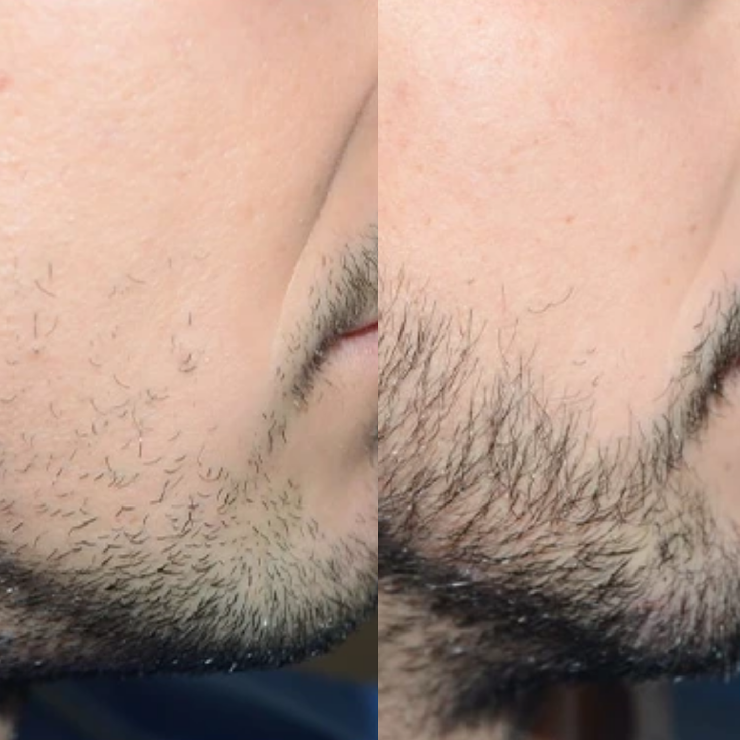 Serum Croissance Barbe et Cheveux