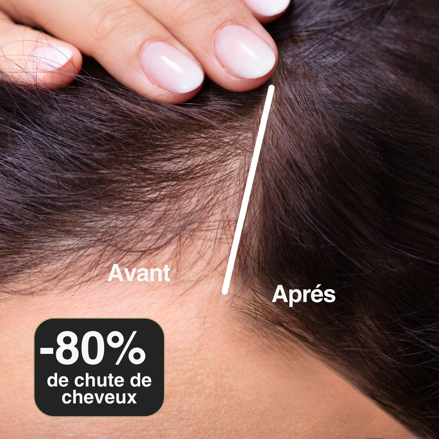 Pack Régénérant Ikleel – Offrez à vos cheveux une nouvelle vie