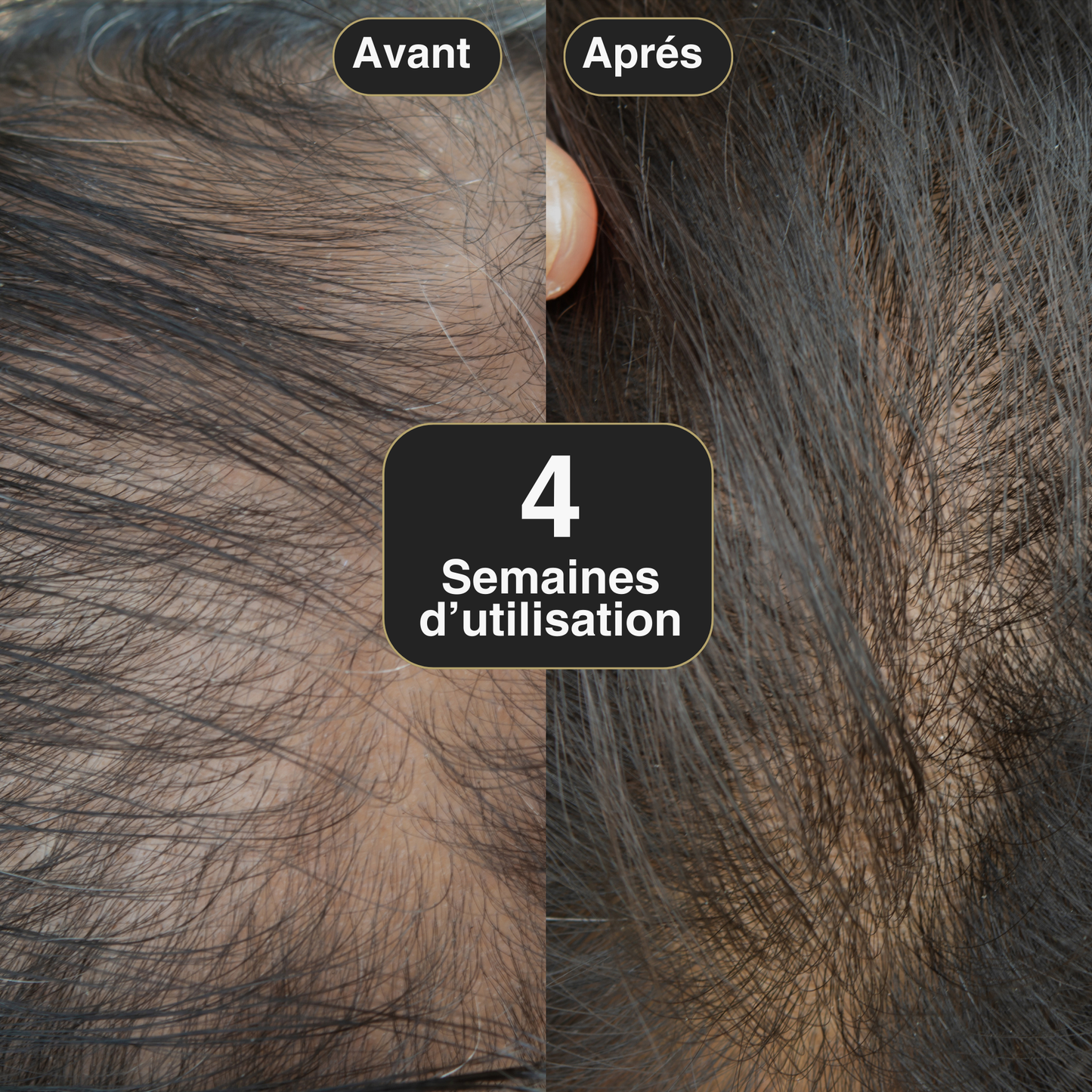 Shampoing Anti-Chute & Croissance Intense Cheveux et Barbe